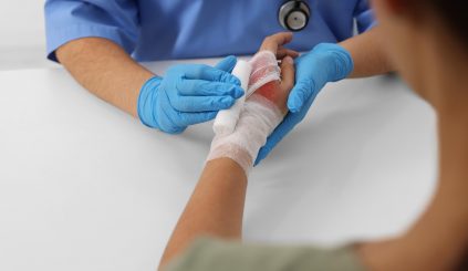Emergency Management of Severe Burns Emergency Management of Severe Burns